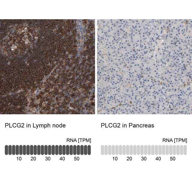 Anti-PLCG2 antibody produced in rabbit