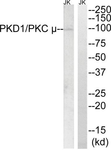 Anti-PKD1 antibody produced in rabbit