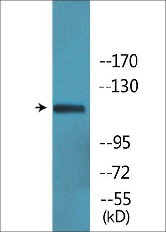 Anti-phospho-Ret (pTyr<sup>1062</sup>) antibody produced in rabbit