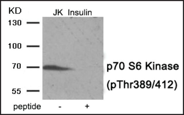 Anti-phospho-p70 S6 Kinase (pThr<sup>389/412</sup>) antibody produced in rabbit