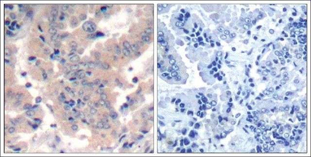 Anti-PIK3R1/PIK3R2/PIK3R3 (Ab-467/199/464) antibody produced in rabbit