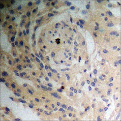 Anti-phospho-Tuberin/TSC2 (pSer<sup>939</sup>) antibody produced in rabbit