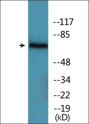 Anti-phospho-ZAP-70 (pTyr<sup>292</sup>) antibody produced in rabbit