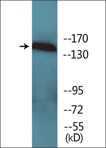 Anti-phospho-VEGFR1 (pTyr<sup>1333</sup>) antibody produced in rabbit