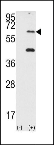 ANTI-PKR (PRKR)(N-TERMINAL) antibody produced in rabbit