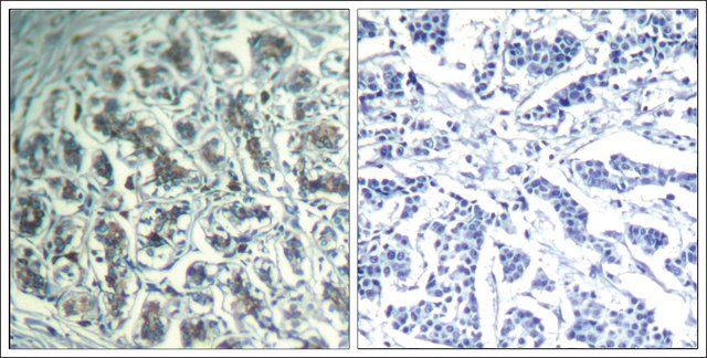 Anti-PLCG1 (Ab-771) antibody produced in rabbit