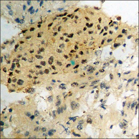 Anti-phospho-Retinoblastoma (pSer<sup>608</sup>) antibody produced in rabbit