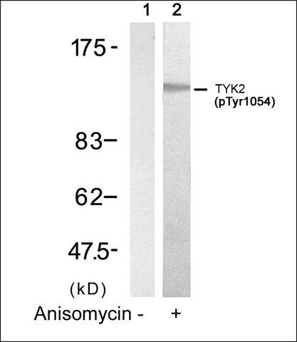 Anti-phospho-TYK2 (pTyr<sup>1054</sup>) antibody produced in rabbit