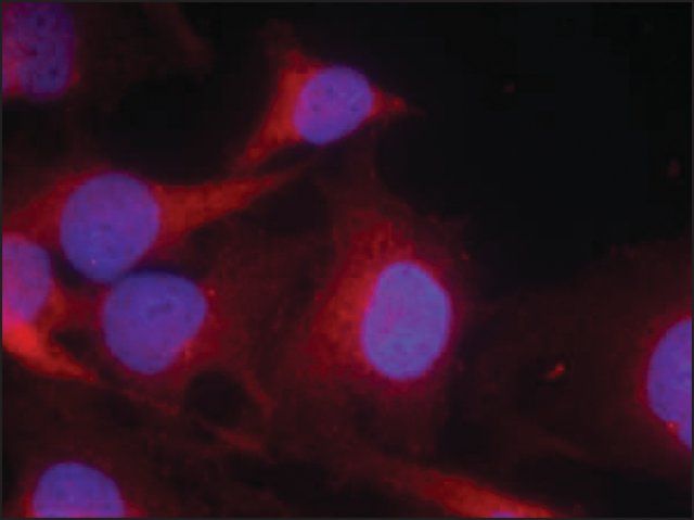 Anti-PLCG2 (Ab-753) antibody produced in rabbit