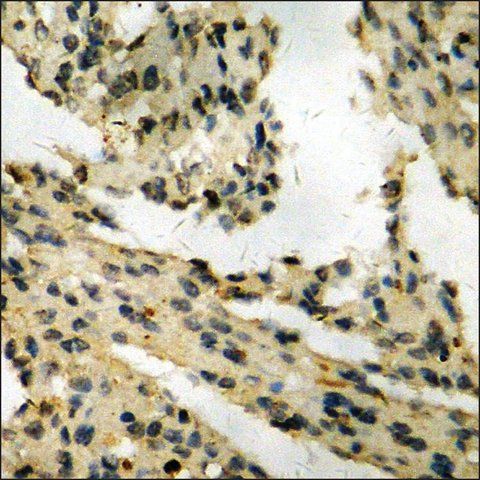 Anti-phospho-Retinoblastoma (pSer<sup>795</sup>) antibody produced in rabbit