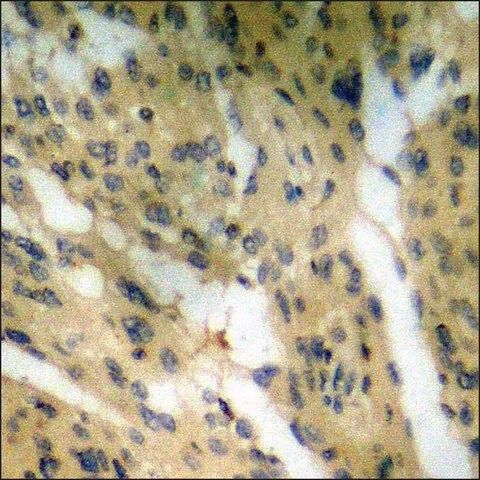 Anti-phospho-ZAP-70 (pTyr<sup>315</sup>) antibody produced in rabbit