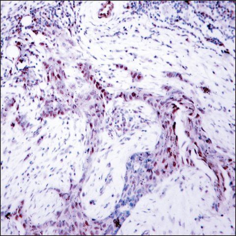 Anti-phospho-PGR (pSer<sup>190</sup>) antibody produced in rabbit