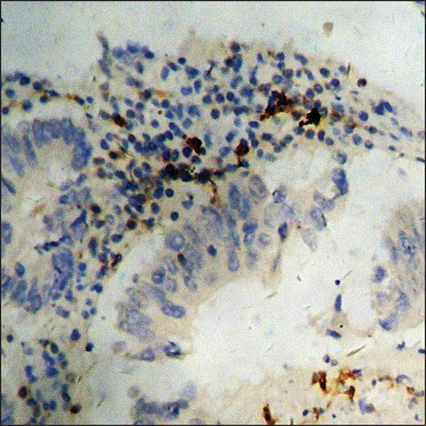 Anti-phospho-Retinoblastoma (pSer<sup>811</sup>) antibody produced in rabbit