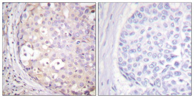 Anti-PKC-PAN antibody produced in rabbit