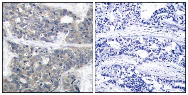 Anti-phospho-RPS6KB1 (pThr<sup>421</sup>) antibody produced in rabbit