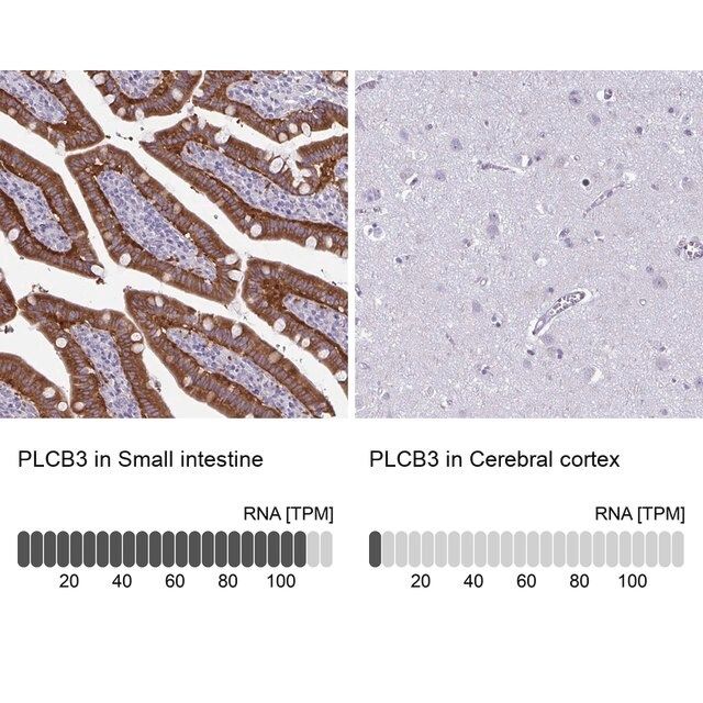 Anti-PLCB3 antibody produced in rabbit