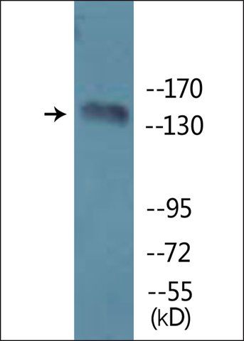 Anti-phospho-PLCB3 (pSer<sup>1105</sup>) antibody produced in rabbit