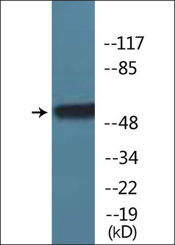 Anti-phospho-TR-1 (pSer<sup>142</sup>) antibody produced in rabbit