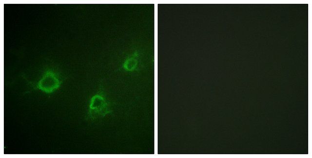 Anti-PLCG1 antibody produced in rabbit