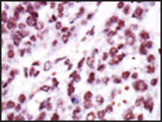 Anti-PKC (N-term) antibody produced in rabbit