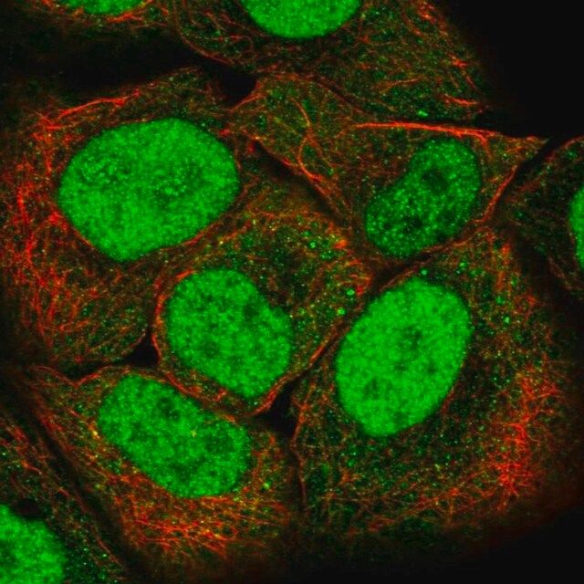 Anti-PMS2 antibody produced in rabbit