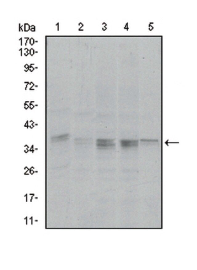 Anti-PPP1CA Antibody, clone 5E9