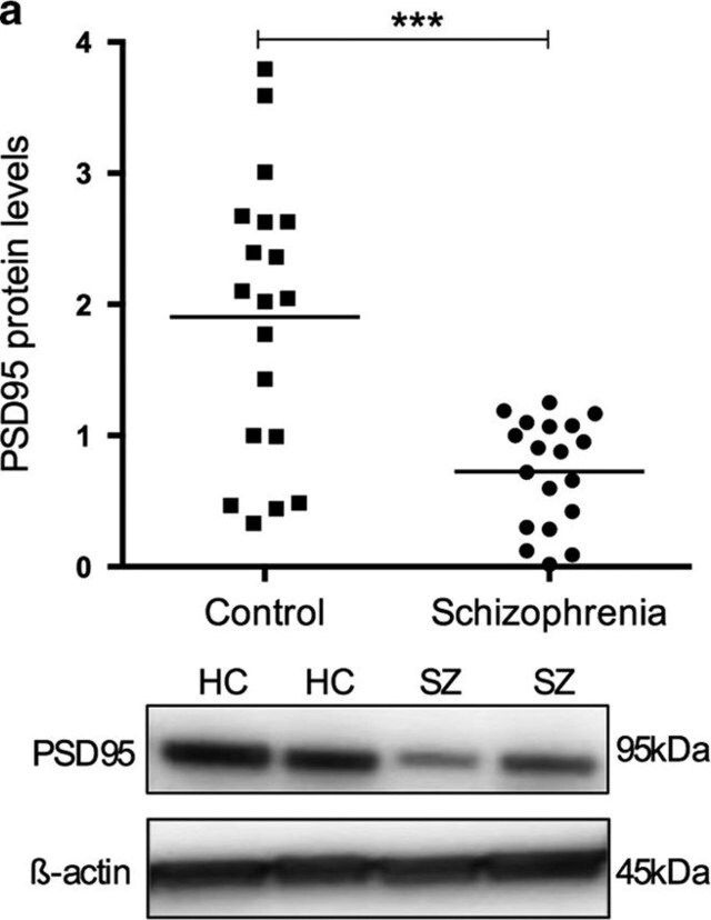 Anti-Post Synaptic Density Protein 95 Antibody, clone 7E3-1B8