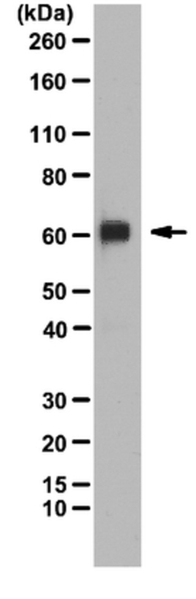 Anti-PRDM14 Antibody