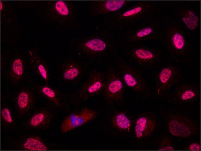 Anti-POLR2A antibody produced in rabbit