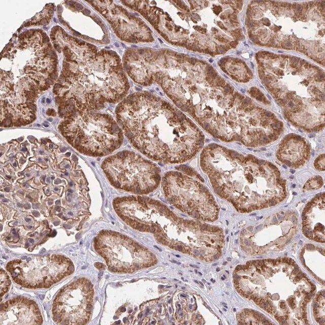 Anti-PPP1CA antibody produced in rabbit