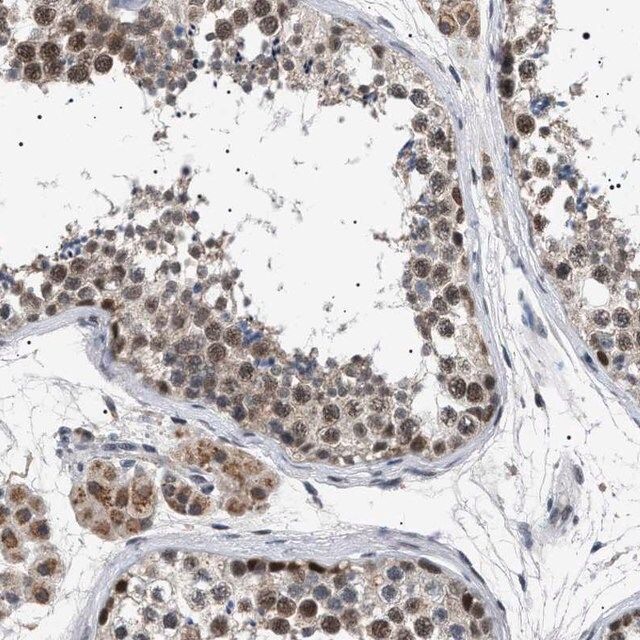 Anti-POLR2A antibody produced in rabbit