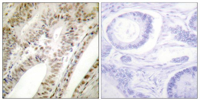 Anti-PML antibody produced in rabbit