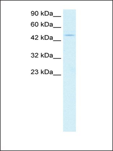 Anti-PPARA antibody produced in rabbit