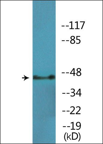 Anti-phospho-p44/42 MAP Kinase (pTyr<sup>204</sup>) antibody produced in rabbit