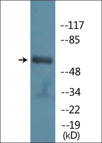 Anti-phospho-PAK1 (pSer<sup>199</sup>) antibody produced in rabbit