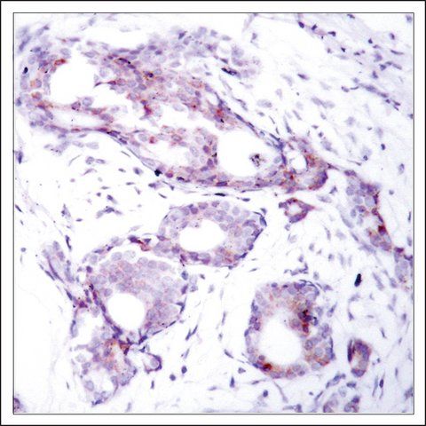 Anti-phospho-MYC (pSer<sup>373</sup>) antibody produced in rabbit