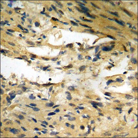 Anti-phospho-Merlin (pSer<sup>10</sup>) antibody produced in rabbit