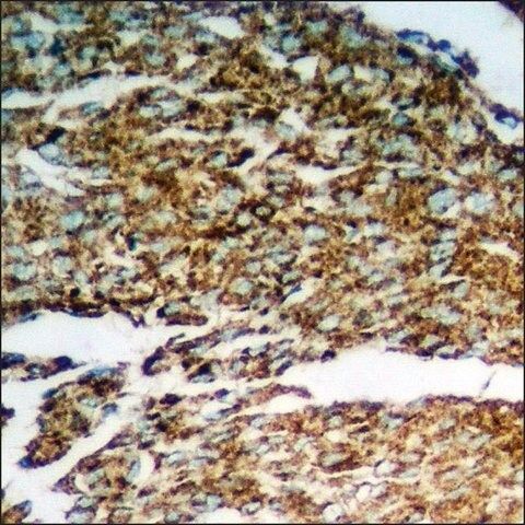 Anti-phospho-n-NOS (pSer<sup>852</sup>) antibody produced in rabbit