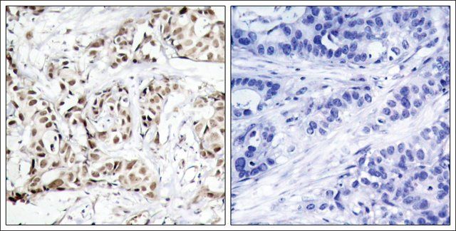 Anti-phospho-MAPK9 (pThr<sup>183</sup>) antibody produced in rabbit