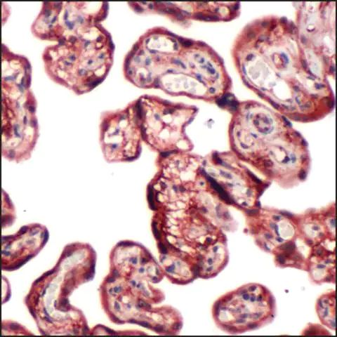 Anti-PI3K P85 antibody, Rabbit monoclonal