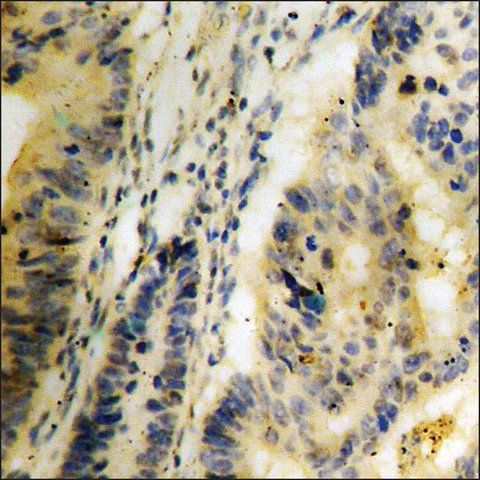 Anti-phospho-Trk C (pTyr<sup>516</sup>) antibody produced in rabbit