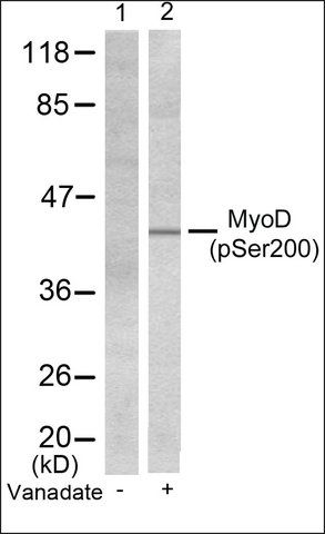 Anti-phospho-MYOD1 (pSer<sup>200</sup>) antibody produced in rabbit