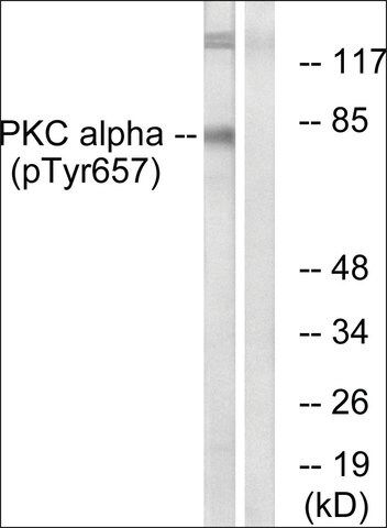 Anti-phospho-PKC  (pTyr<sup>657</sup>) antibody produced in rabbit