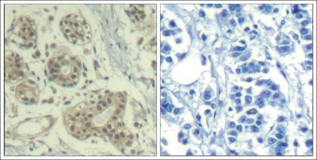 Anti-phospho-MDM2 (pSer<sup>166</sup>) antibody produced in rabbit