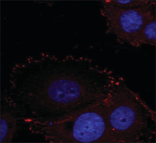 Anti-phospho-PTK2 (pTyr<sup>576</sup>/pTyr<sup>577</sup>) antibody produced in rabbit