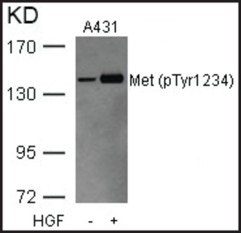 Anti-phospho-MET (pTyr<sup>1234</sup>) antibody produced in rabbit