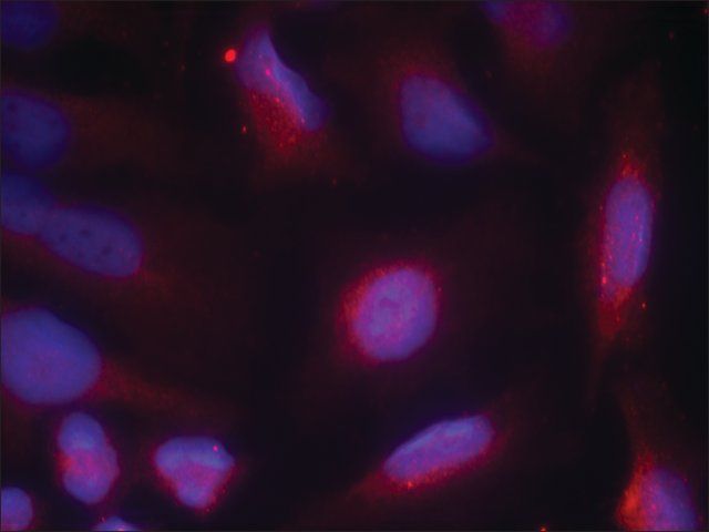 Anti-phospho-NTRK1 (pSer<sup>791</sup>) antibody produced in rabbit