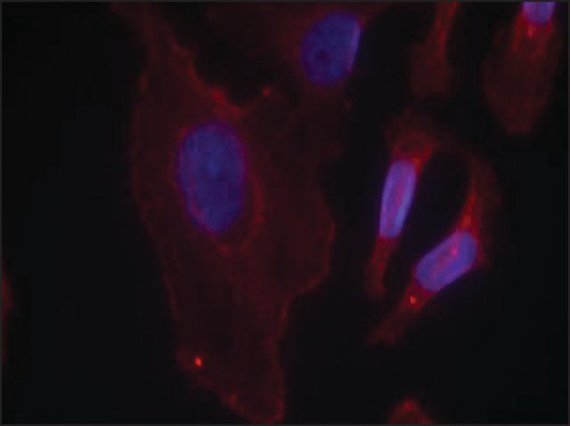 Anti-phospho-PLCG2 (pTyr<sup>753</sup>) antibody produced in rabbit