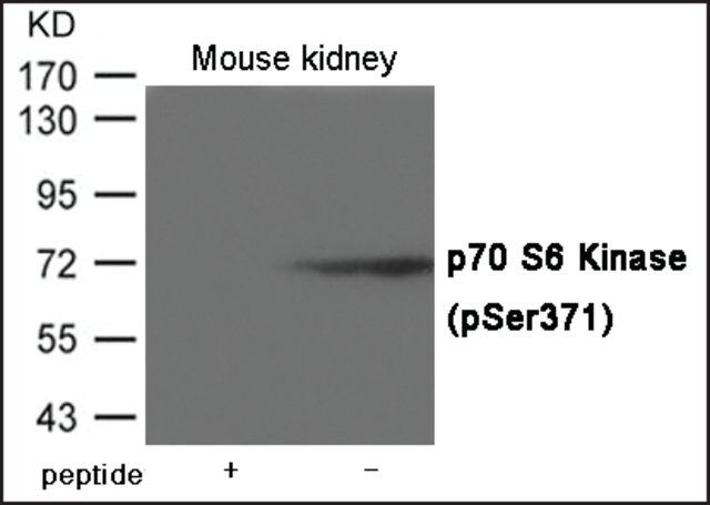 Anti-phospho-p70 S6 Kinase (pSer<sup>371</sup>) antibody produced in rabbit