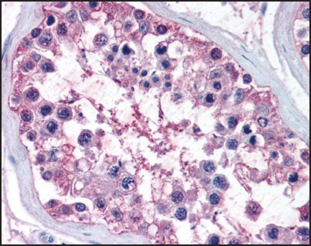 Anti-NR0B1 (AB1) antibody produced in rabbit